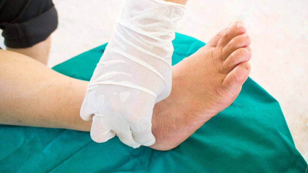 Person getting treatment from neuropathy