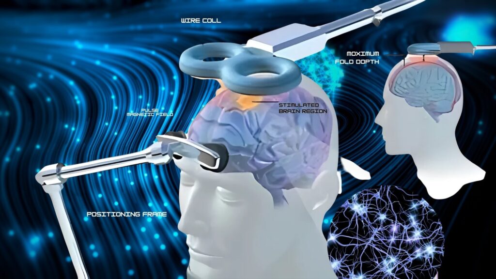 Example of what a session of transcranial magnetic stimulation looks like