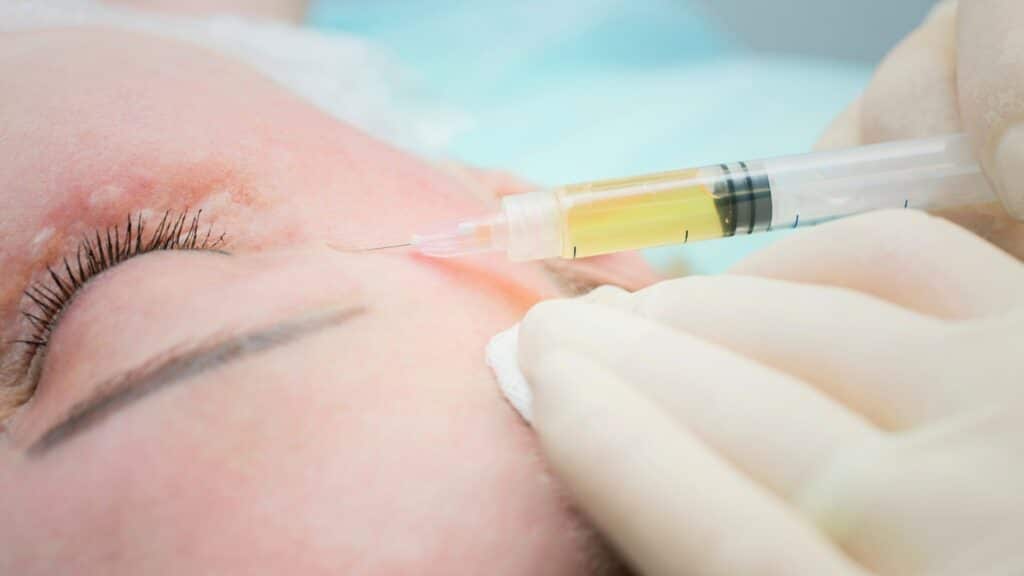 image of anti-aging regenerative therapy injections