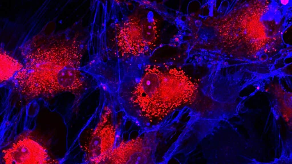 Stem Cell treatments represented by an image of mesenchymal stem cells mscs